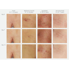 Mark Intensive Soothing Cream for Sensitive Skin Eczema and Rosacea 30 ml