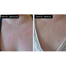 Mark Intensive Soothing Cream for Sensitive Skin Eczema and Rosacea 30 ml